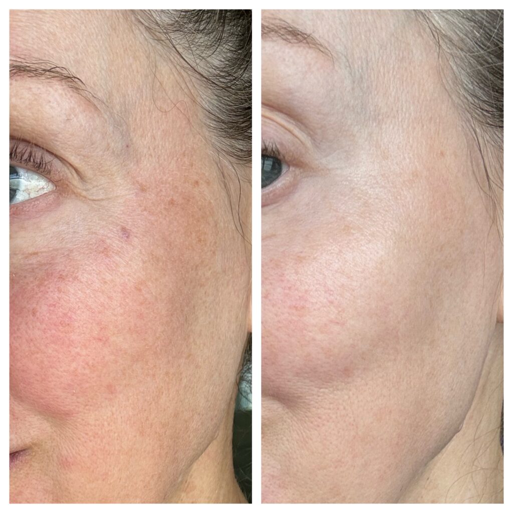 Meet Your Skin’s New Power Duo: Toskani Lumicen + HA Glowcomplex